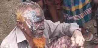 Abuse Allegation Against Elderly Person Arrested in Durgapur abuse-allegation-against-elderly-person-arrested-in-durgapur